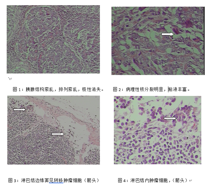 猫原发性胰腺癌的病例